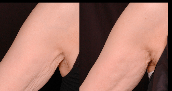 1394423766-1927282353_n