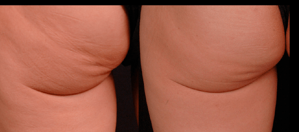 1394423766-3459510594_n